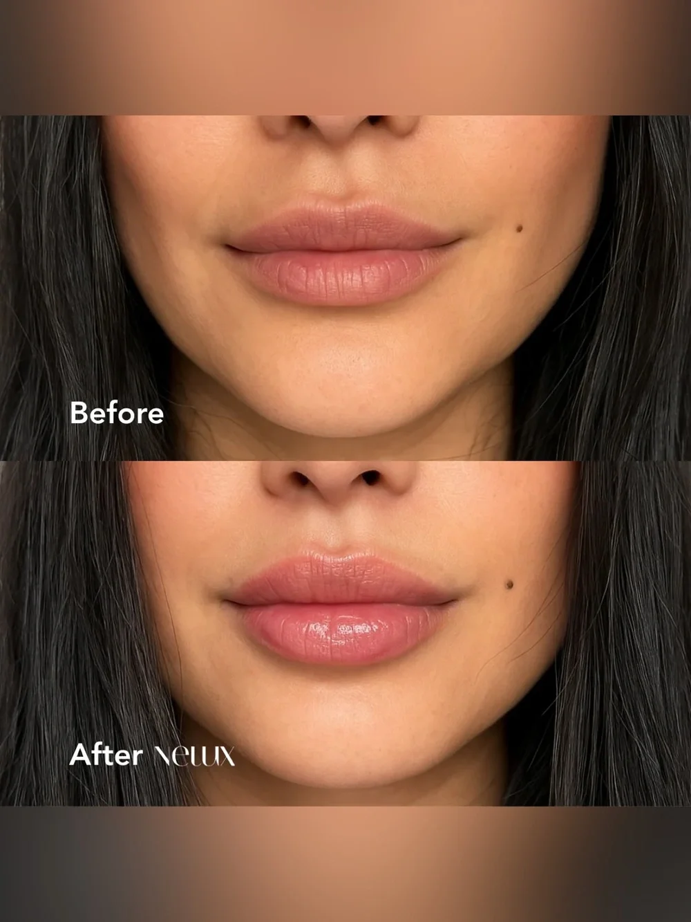 Nelux Hyaluronic Acid Lip Plumper Serum Vegan Cruelty-Free New in Box